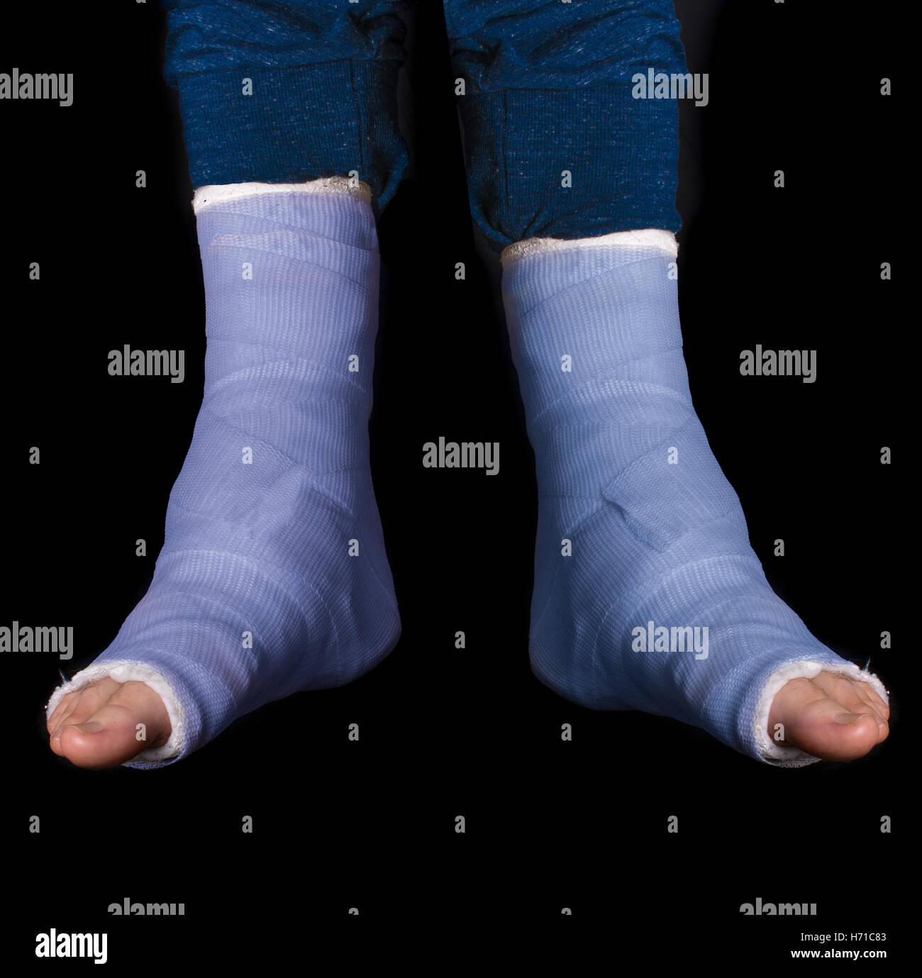 Broken ankle hi-res stock photography and images - Alamy