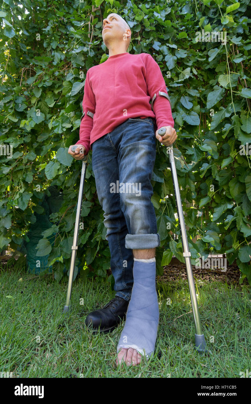Young man with a broken ankle and a blue fiberglass and plaster cast on