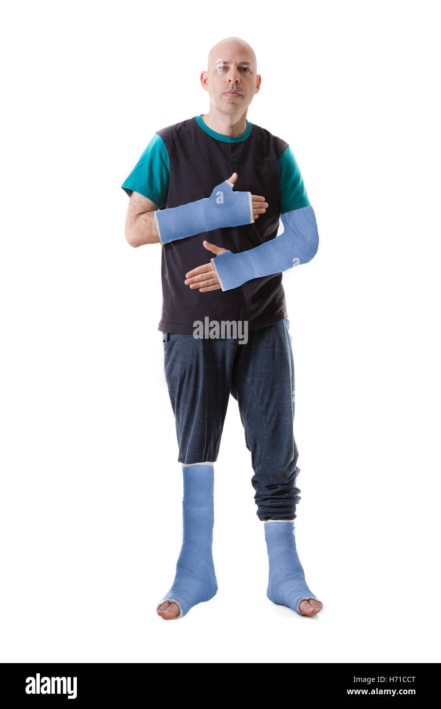 Young man after a terrible accident with four broken limbs - broken arm, wrist, and two ankles. To arms and two legs in blue fib Stock Photo