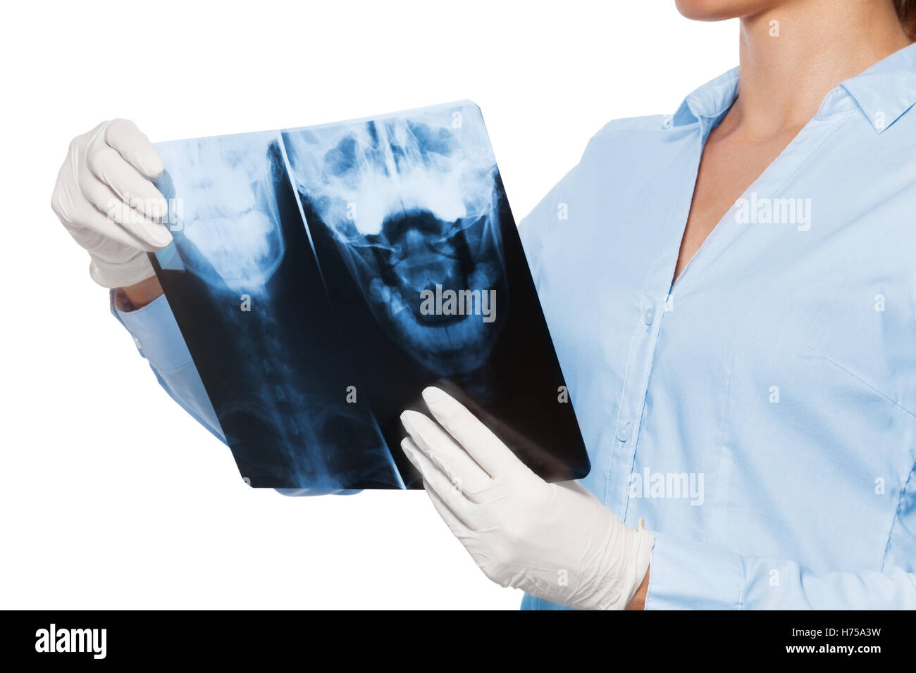 Xray of spinal cord hi-res stock photography and images - Alamy