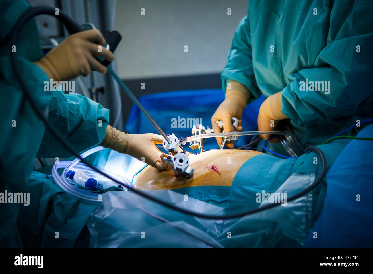 ROBOT-ASSISTED SURGERY Stock Photo