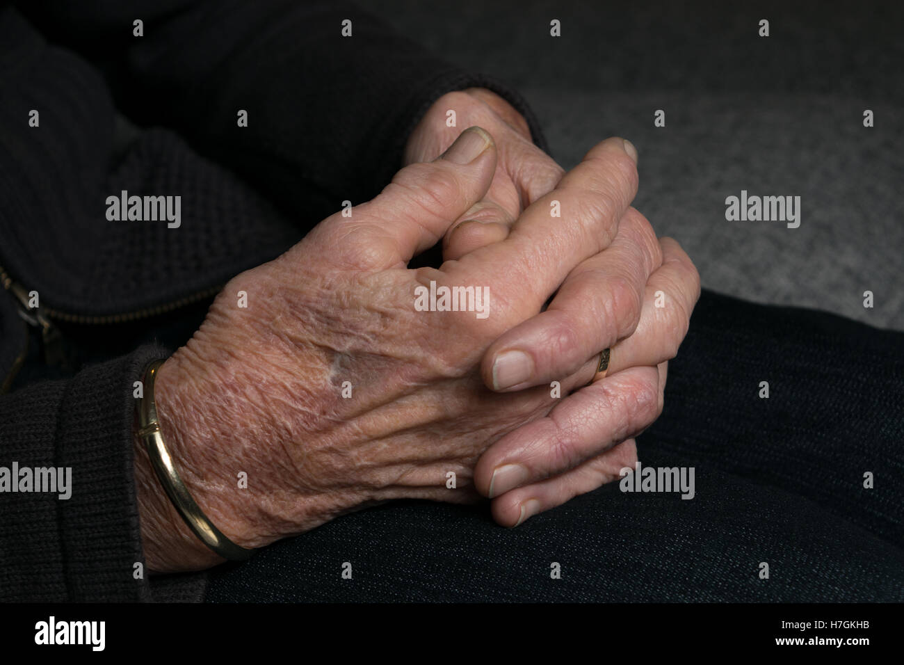 Old lady hands with arthritis aka osteoarthritis Stock Photo Alamy