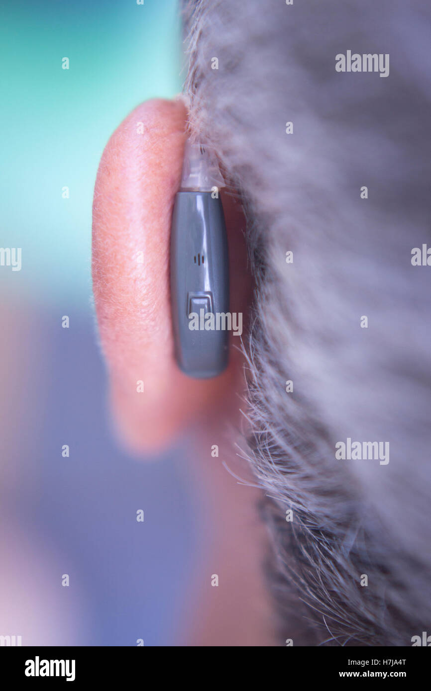 Modern digital hearing aid device for deaf and hard of hearing patients