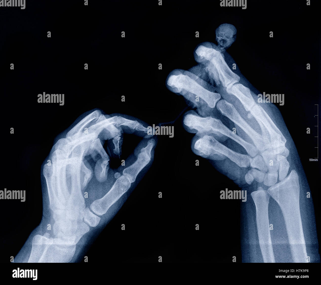 Xray image of human arms holding unknown creature Stock Photo