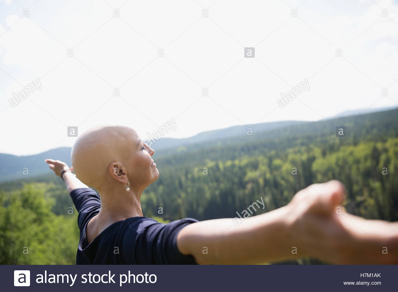 Female cancer survivor with shaved head with arms outstretched at sunny remote rural view Stock Photo