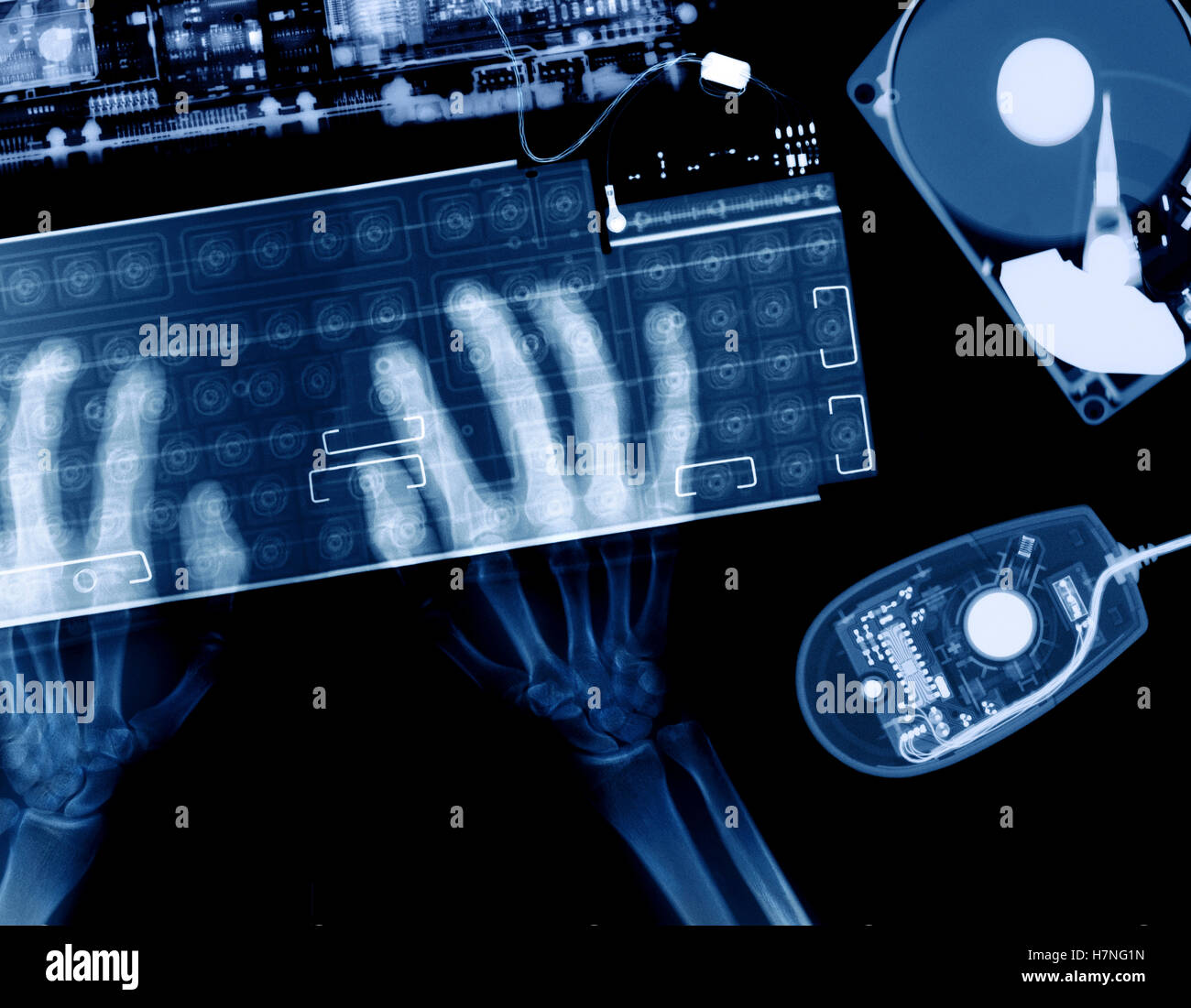 x-ray of arm and hands at computer keyboard Stock Photo