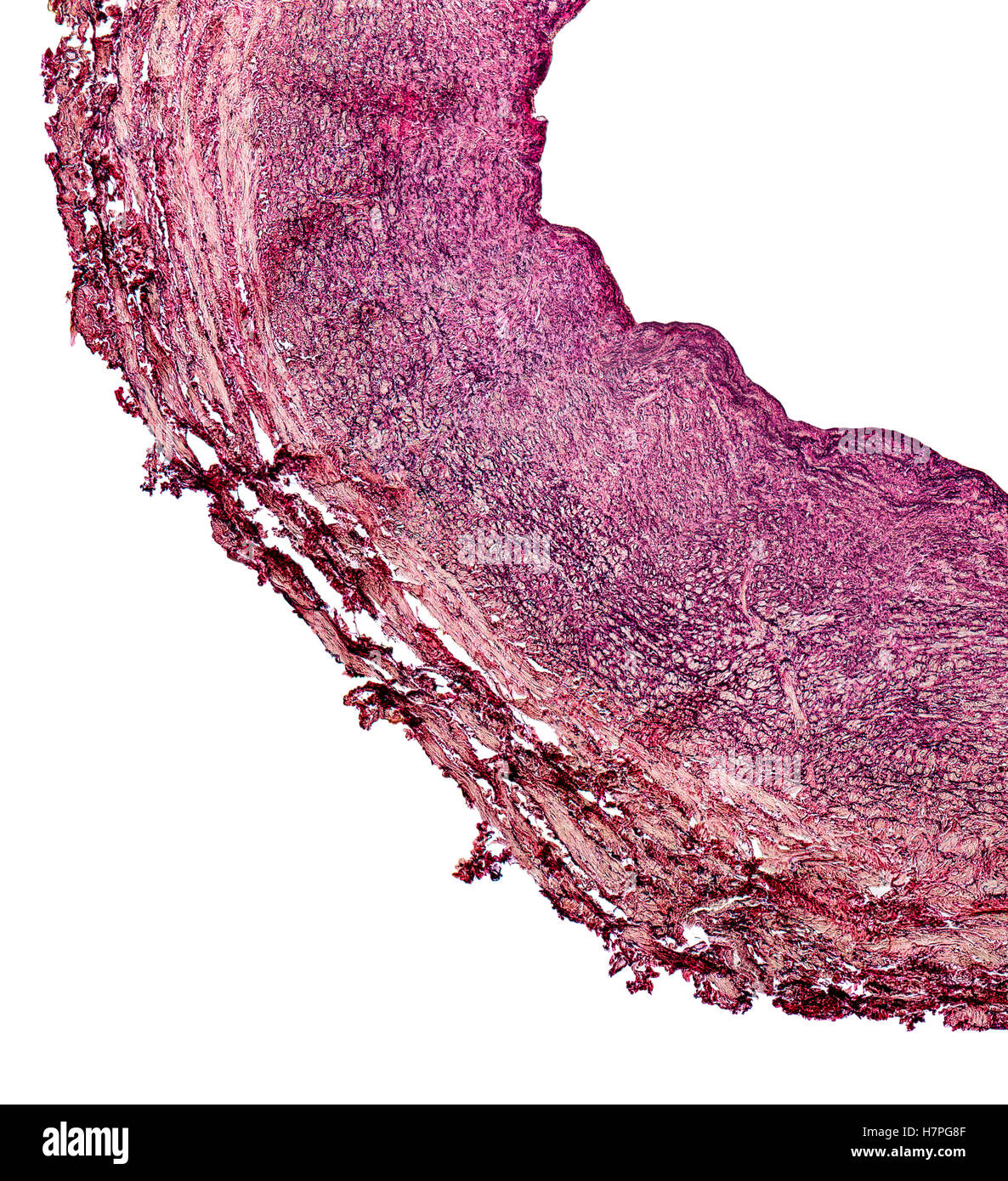 microscopic detail showing a cross section of a human blood vessel Stock Photo