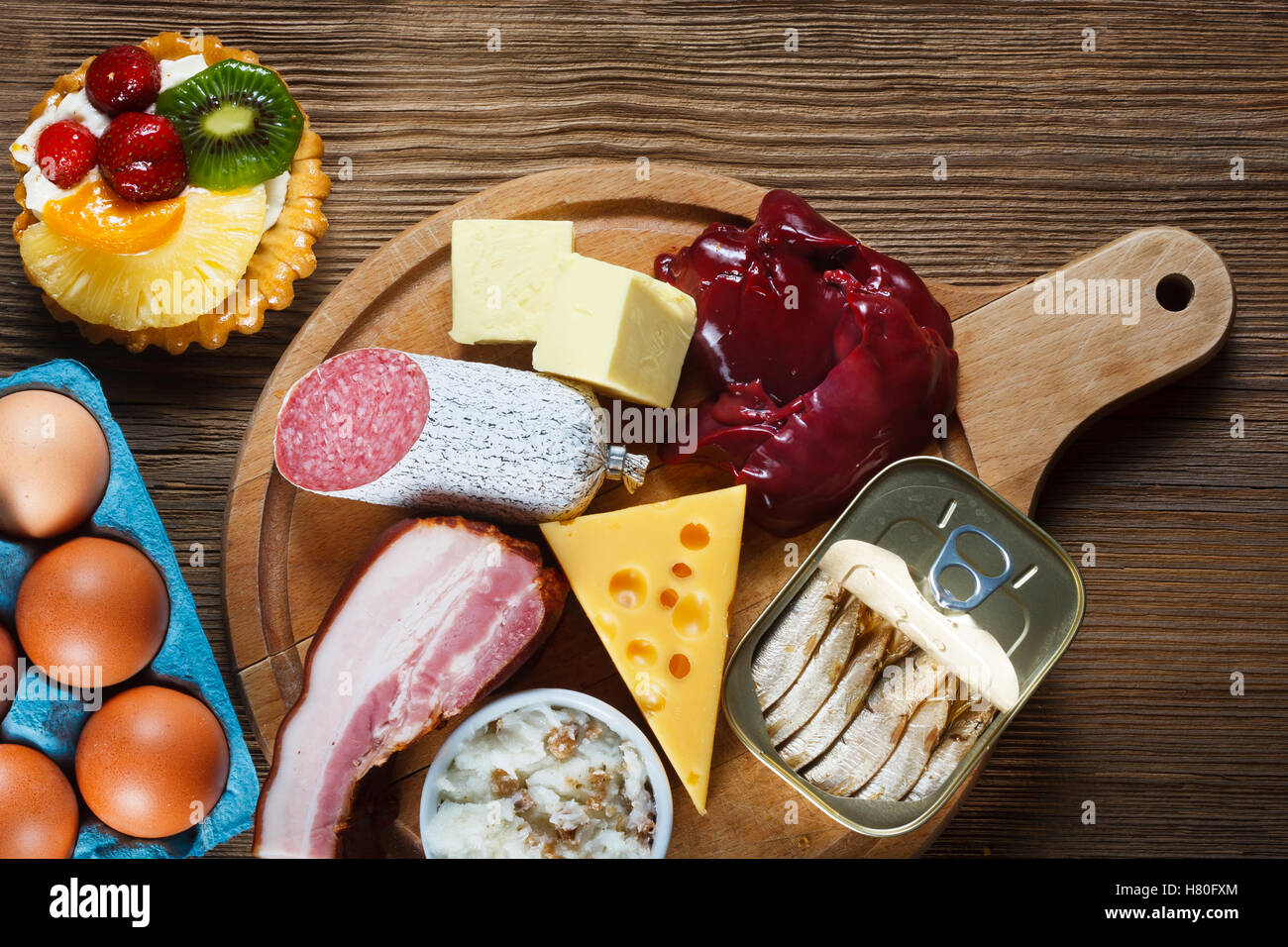 Foods rich in cholesterol as eggs, liver, yellow cheese, butter, bacon