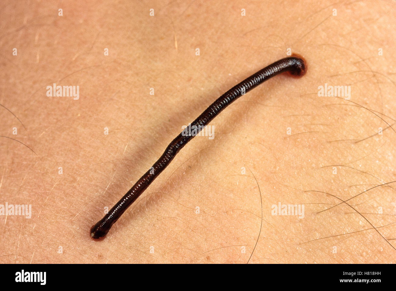 Leech on skin in rainforest, West Papua, Indonesia Stock Photo - Alamy