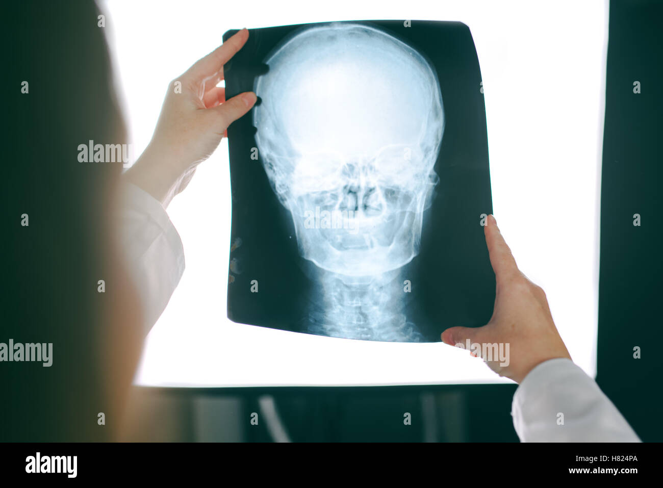 Female doctor looking at x-ray film of human head, woman in medical hospital interior examining xray screening image of skull Stock Photo