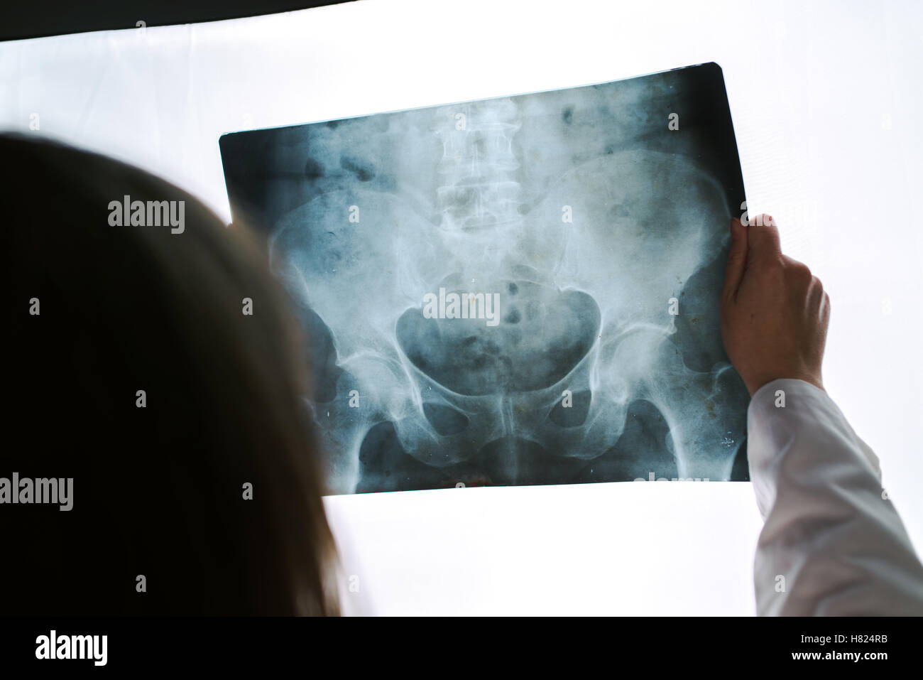 Female doctor examining pelvis x-ray in hospital office, medical professional in white uniform analyzing hip image in clinic. Stock Photo