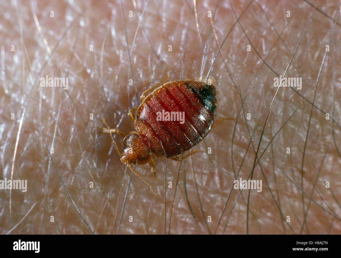 Bed Bug (Cimex lectularius) on human skin, bloodsucking nocturnal parasite, worldwide