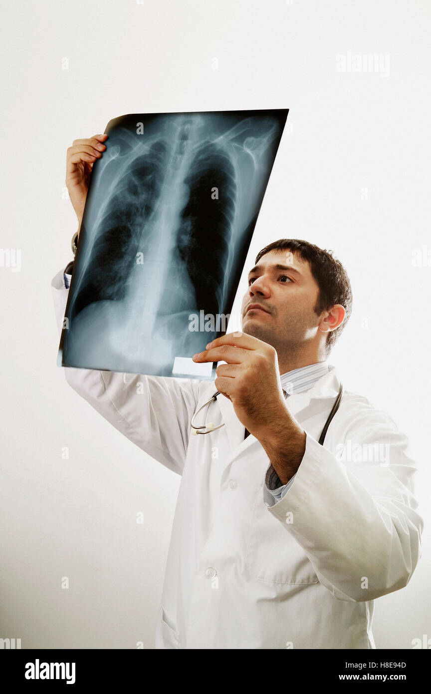 Chest x ray 30 year old hi-res stock photography and images - Alamy