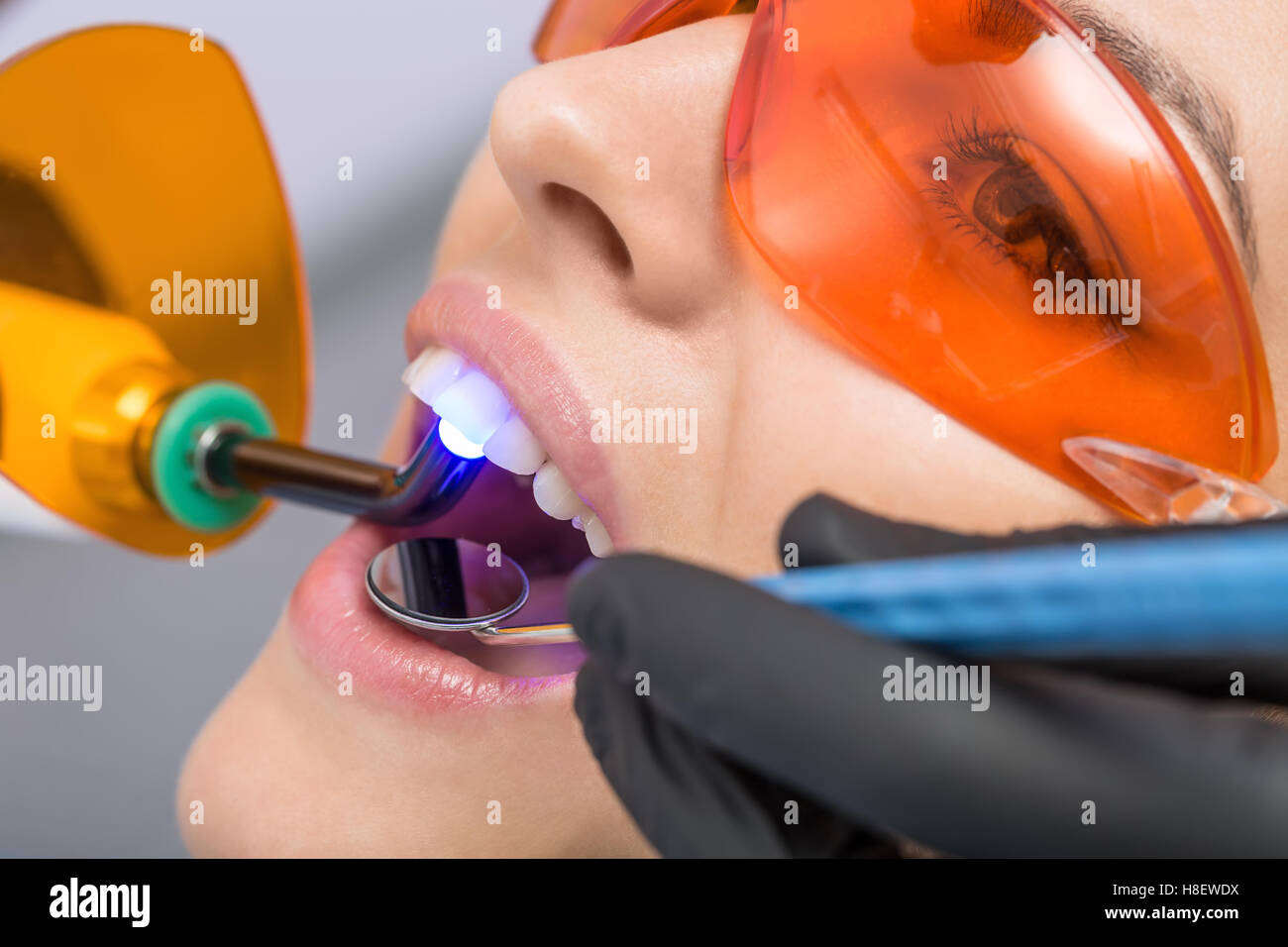 Dental Curing Light Stock Photos & Dental Curing Light Stock Images Alamy