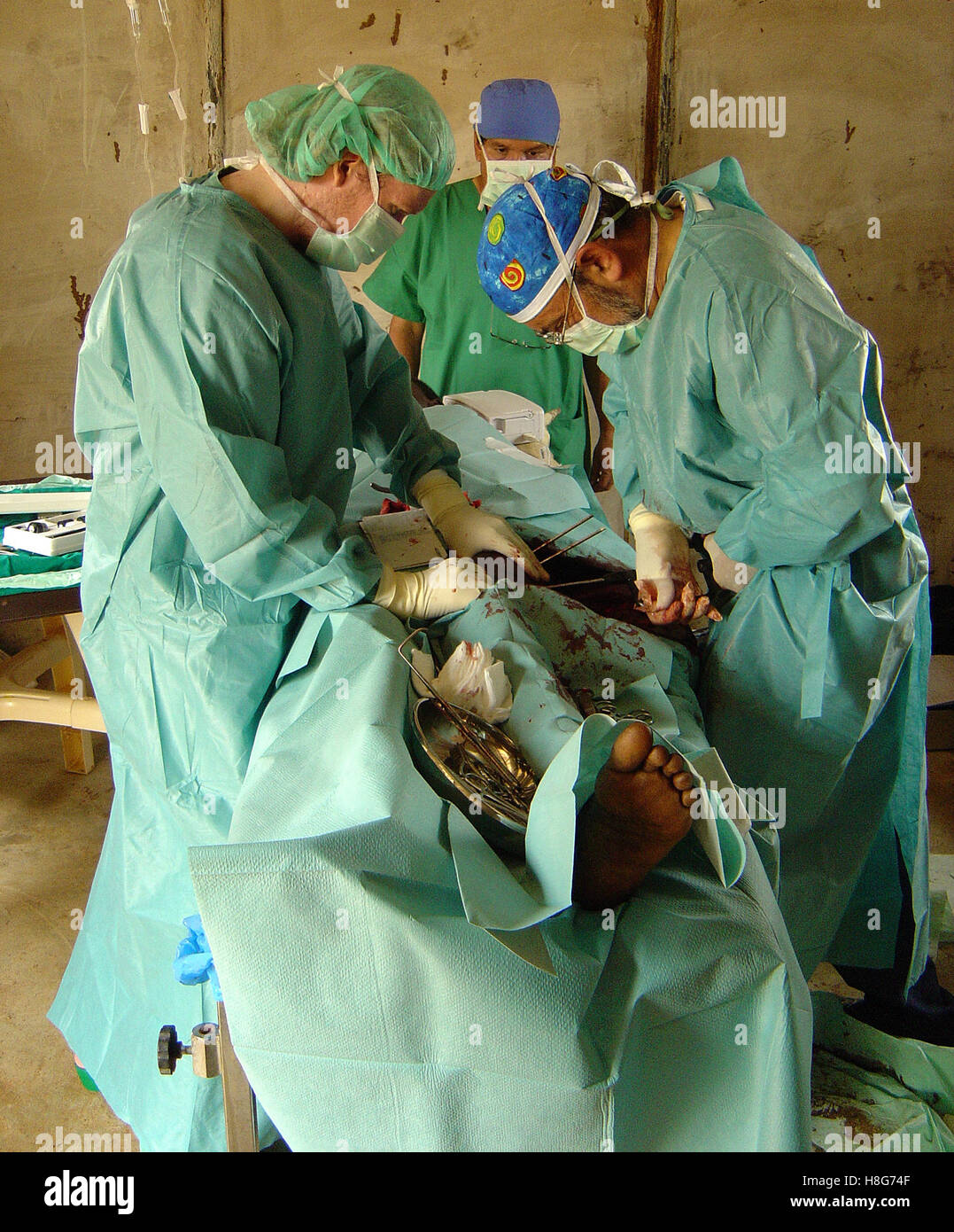 31st August 2005 An ICRC Field Surgical Team perform surgery on an SLA soldier in a guard's hut in northern Darfur, Sudan. Stock Photo