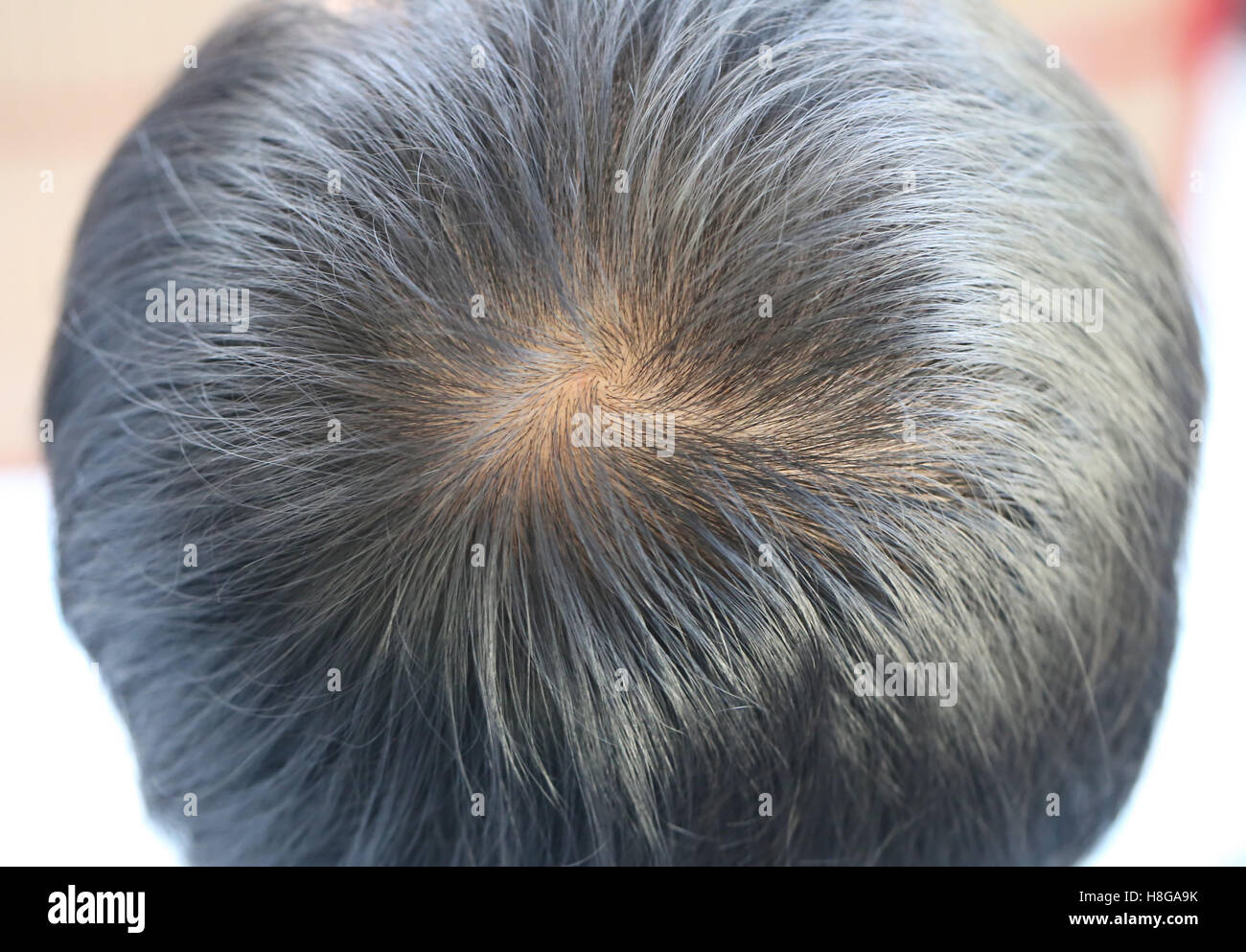 Focus on lose one's hair of a man,concept of health and beauty. Stock Photo