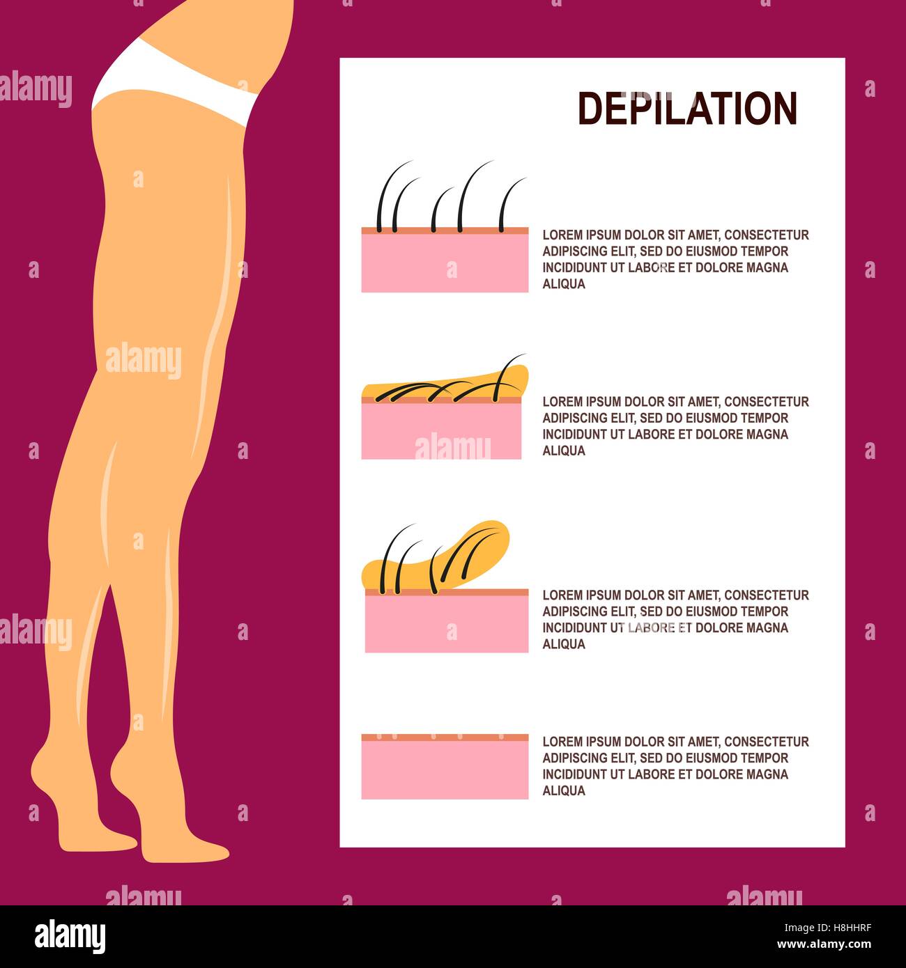 Depilation Vector illustration Stock Vector Image & Art Alamy