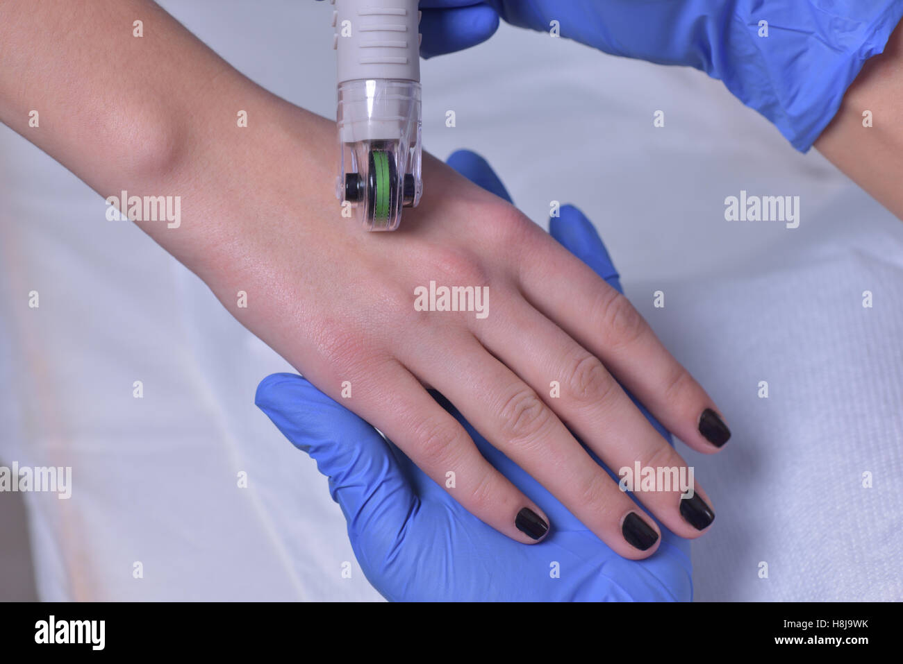 Young beautiful woman gets hand professional skin treatment Stock Photo
