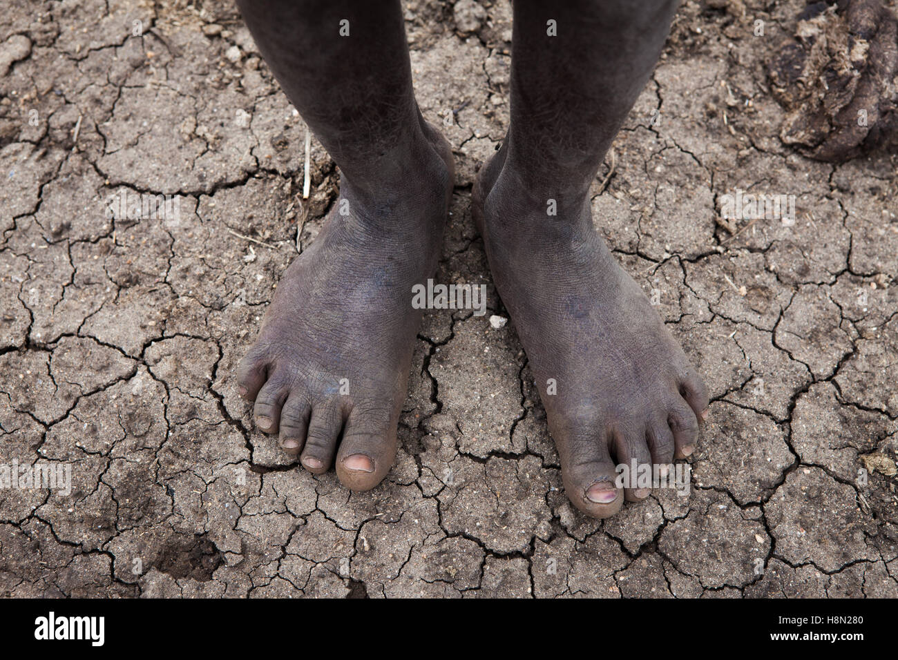 African Feet
