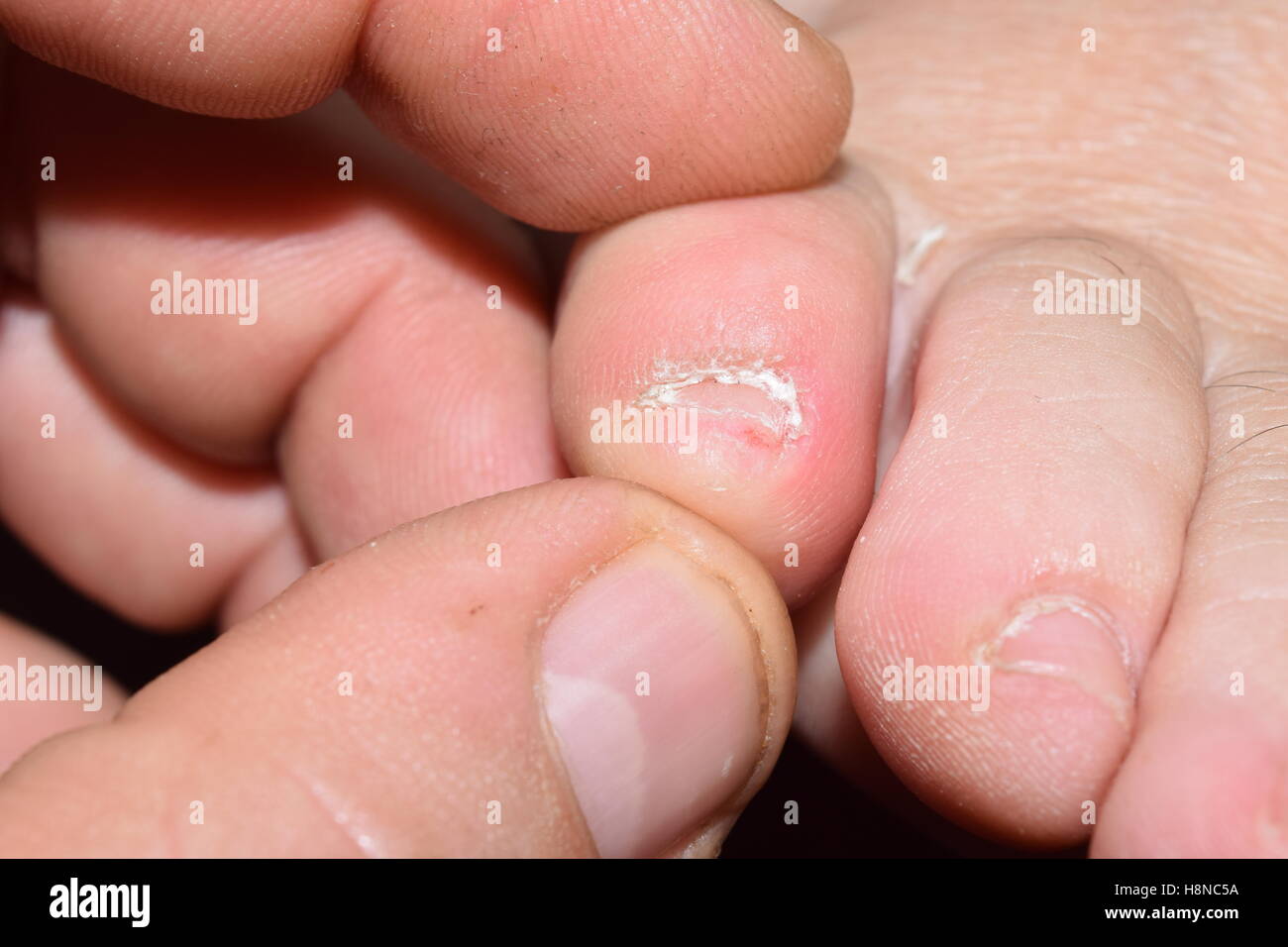 Holding a female's toe Stock Photo