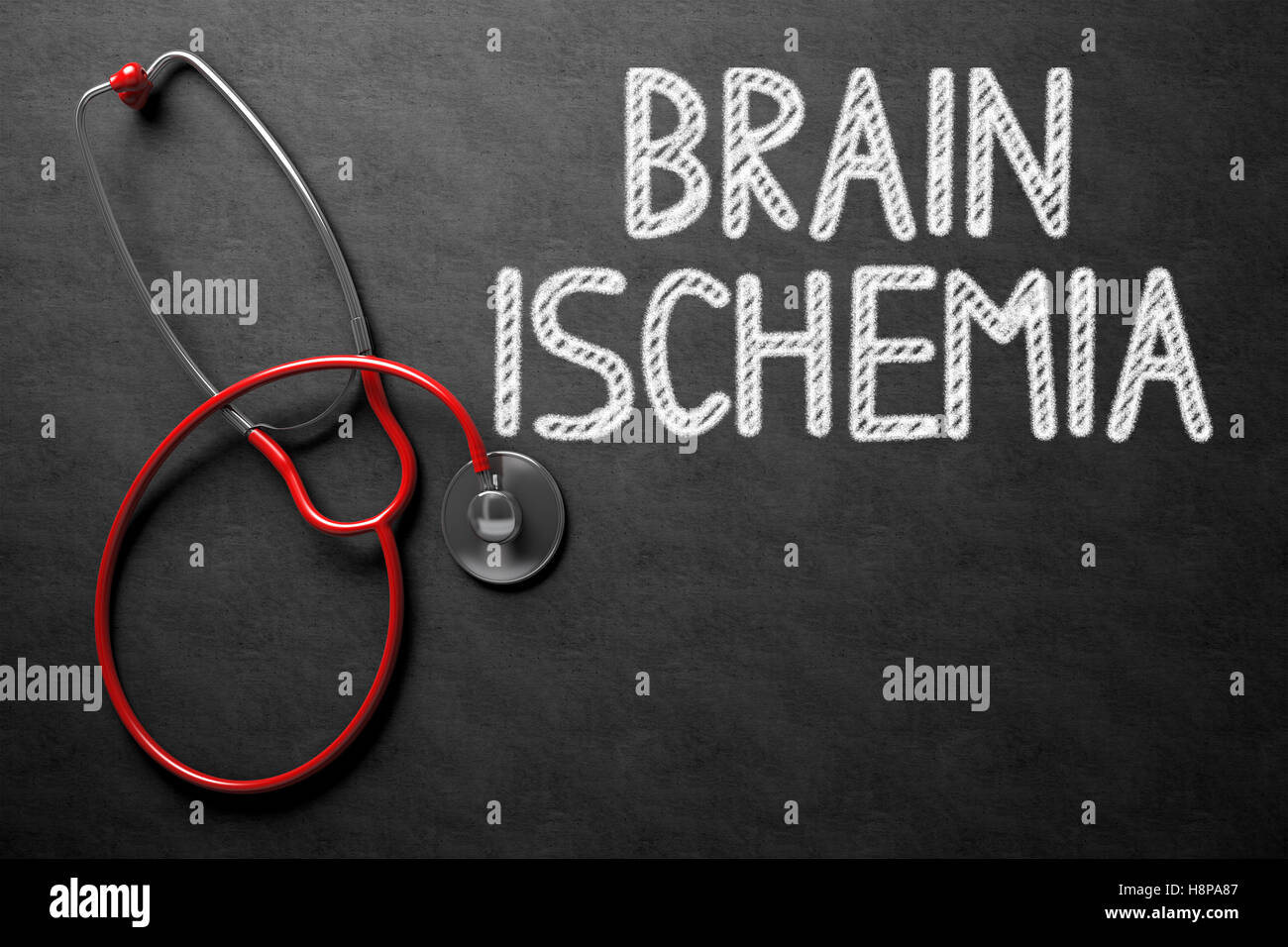 Brain Ischemia Handwritten on Chalkboard. 3D Illustration Stock Photo ...