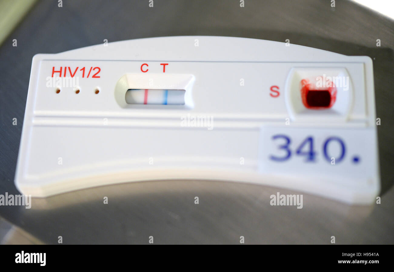 The test strip on an HIV quick has changed colour to indicate a
