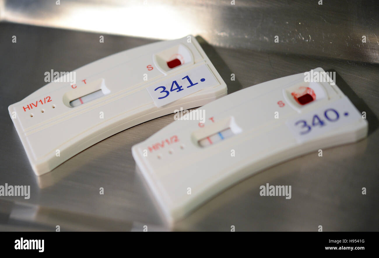 Two test strips of HIV quick tests can be seen coloured after