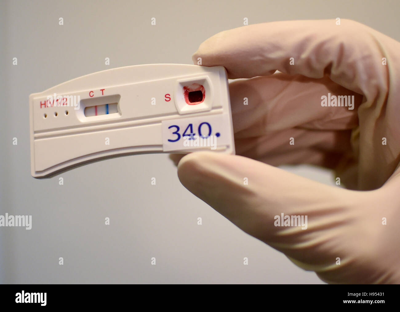 Positive aids test strip hires stock photography and images Alamy Positive aids test strip hires stock photography and images Alamy