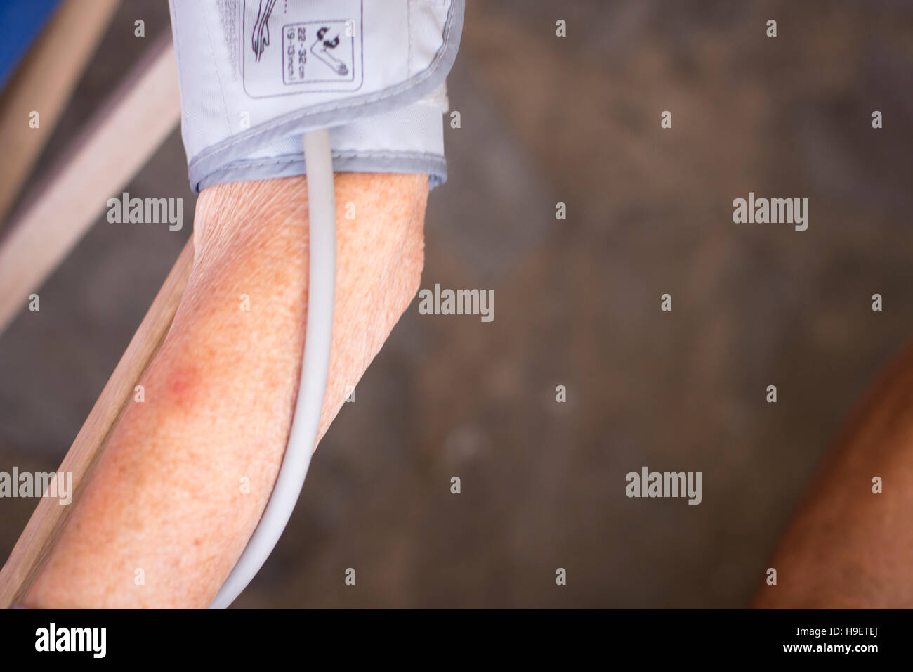 Cardiac blood pressure and irregular heart beat pulse rate meter to