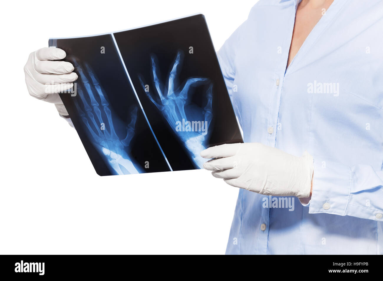 Doctor examining hand fingers glove hires stock photography and images