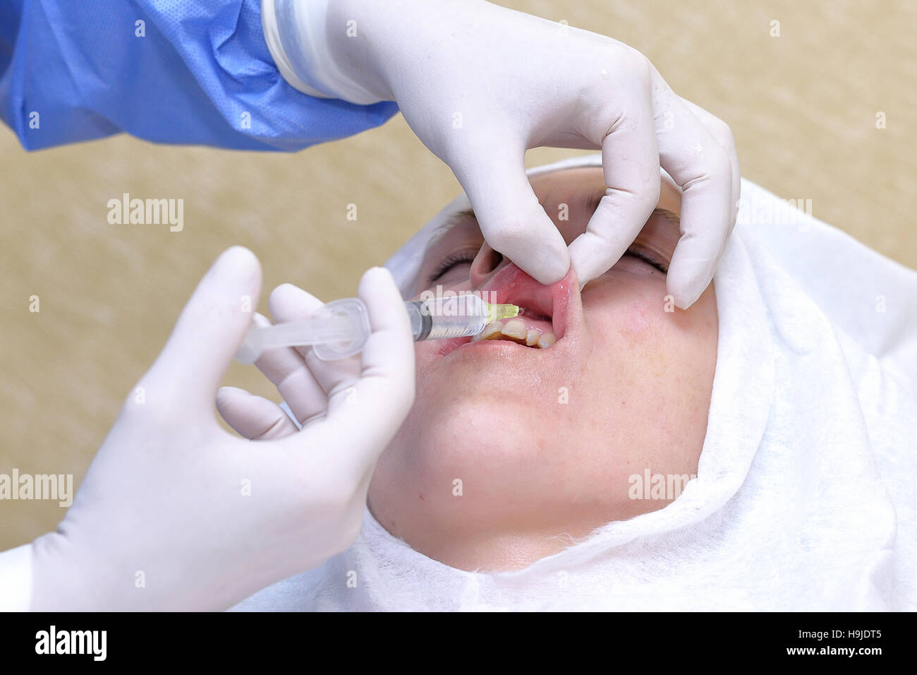 Anesthetic hires stock photography and images Alamy