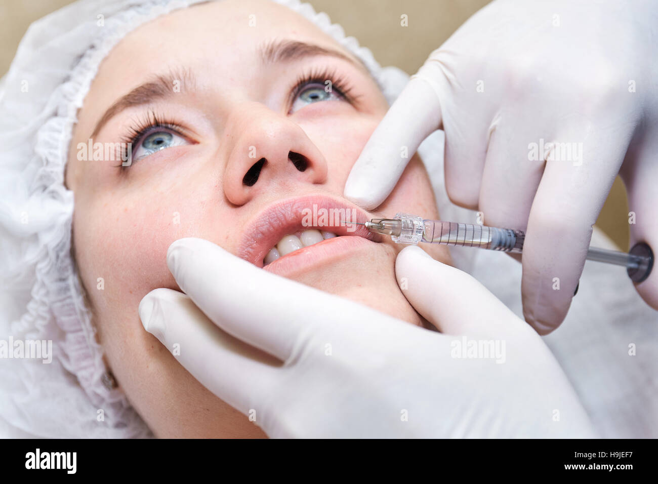 Lip injection procedure. Lips filler. Young woman. Stock Photo