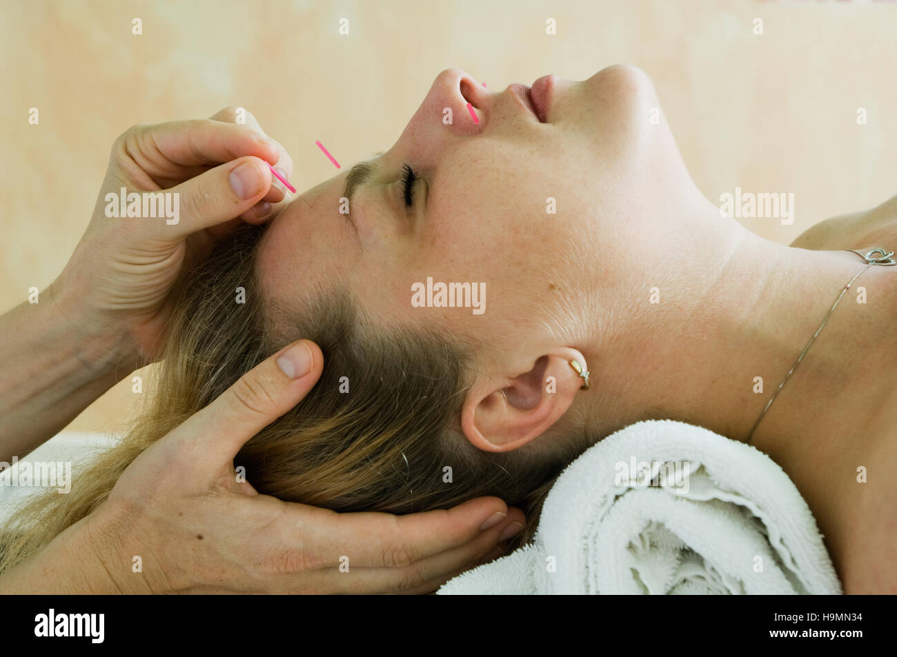 Acupuncture chinese medicine hi-res stock photography and images - Alamy