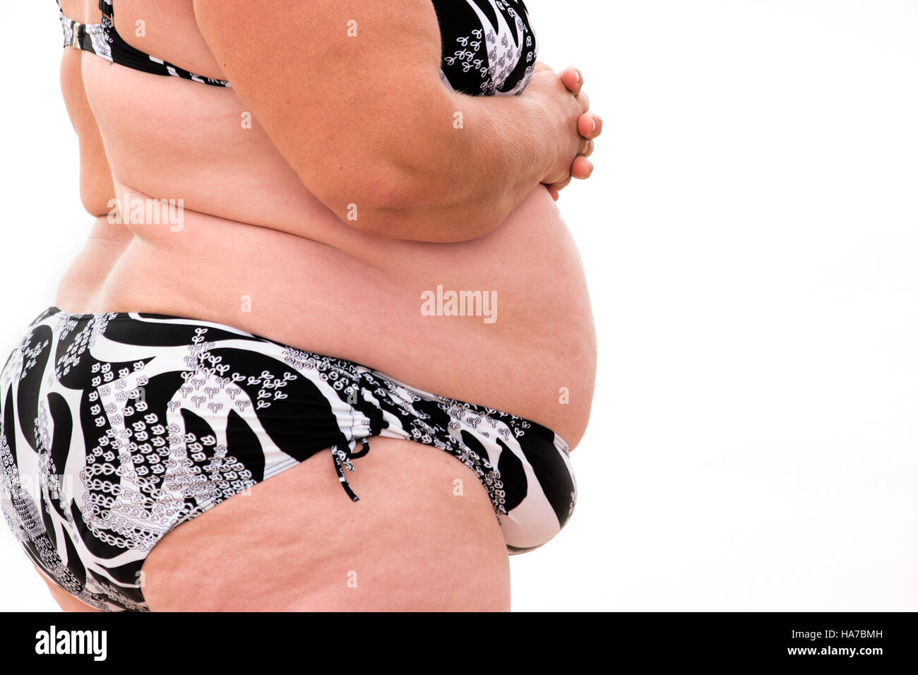 Тело толстой женщины
