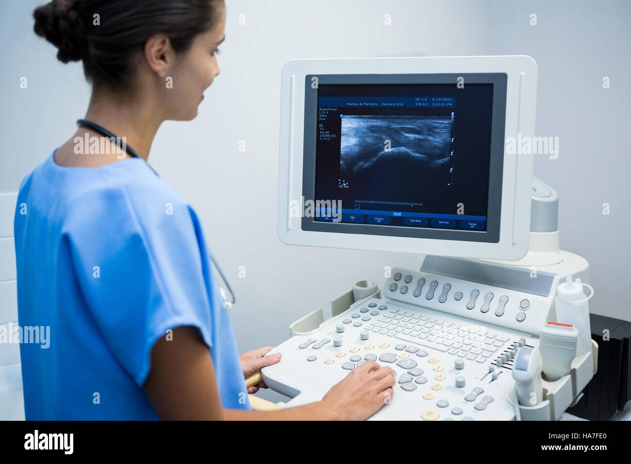 Portable Ultrasound Machine for Home Use