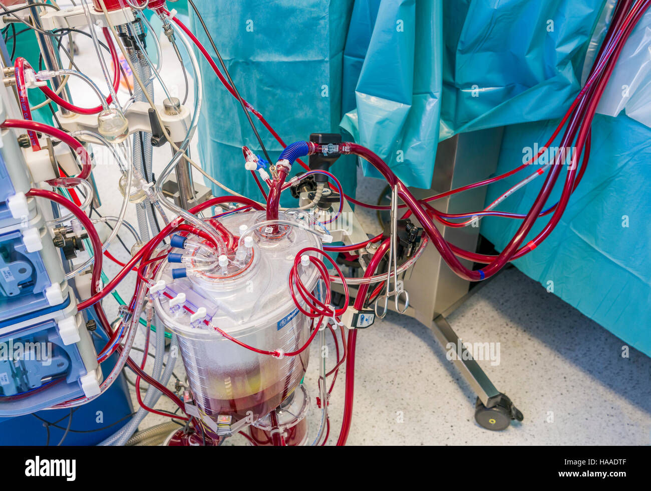 Heart Lung machine-Heart valve replacement surgery, operating room, Reykjavik, Iceland Stock Photo