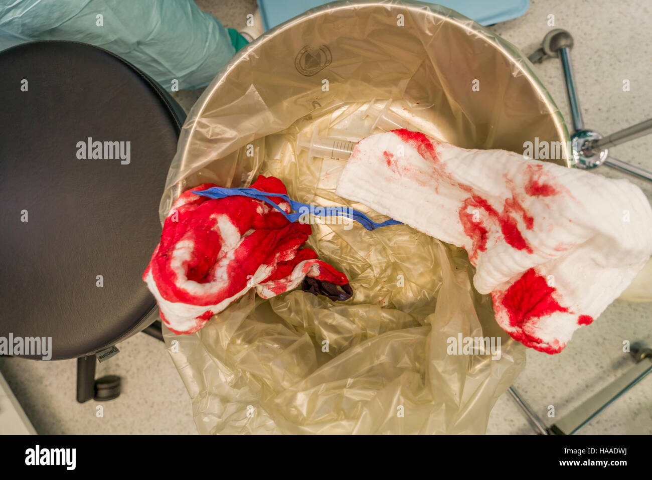 Blood on surgical sponges. Heart valve replacement surgery, operating room, Reykjavik, Iceland. Stock Photo
