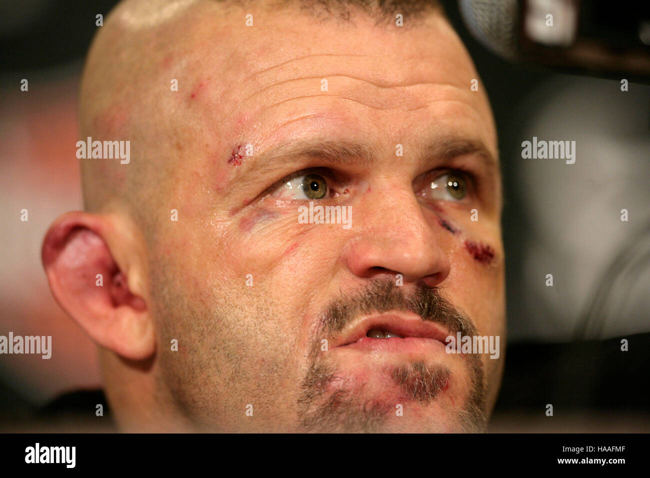 Chuck Liddell at a postfight press conference during UFC 79 at the