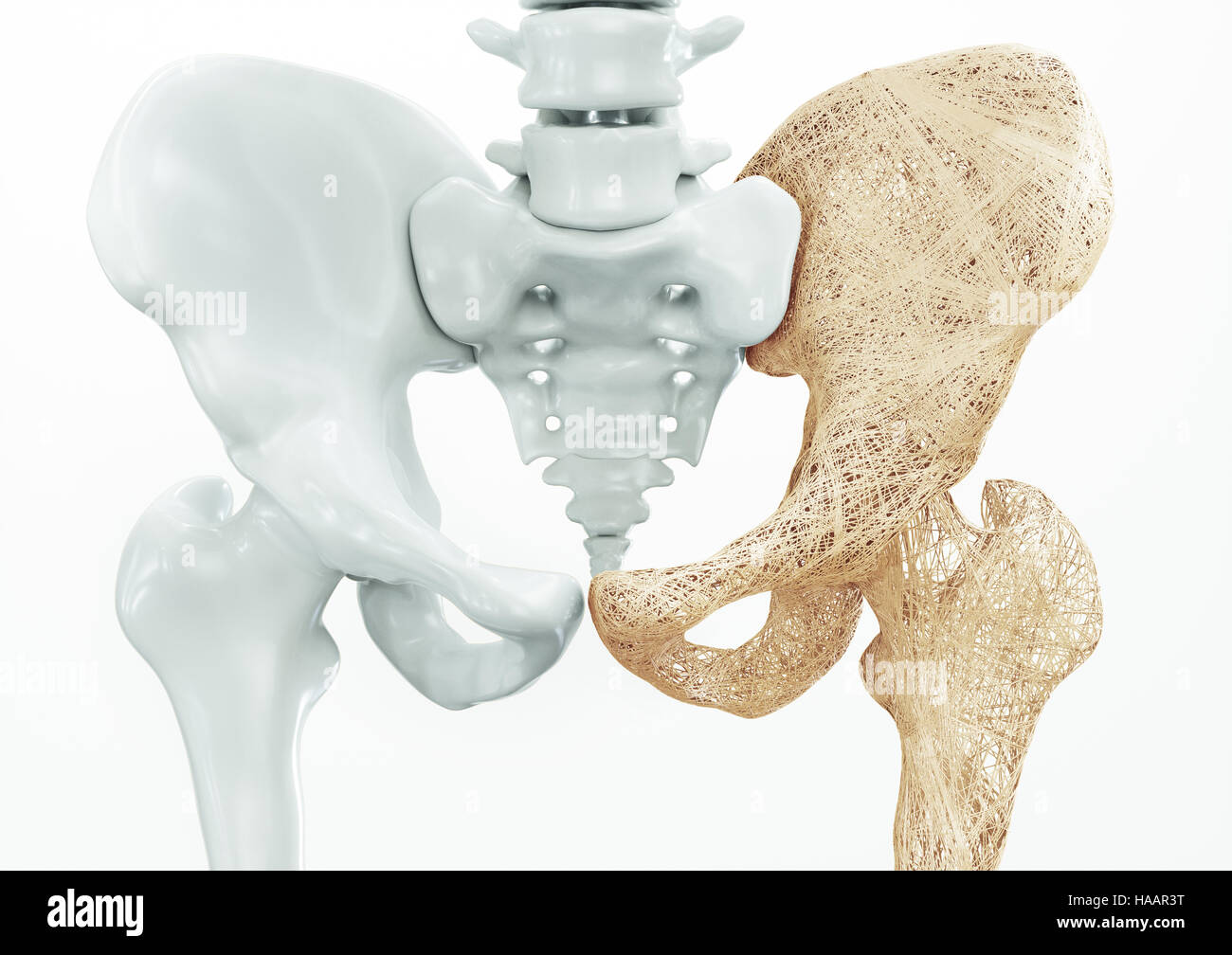 Osteoporosis - upper limb bones - 3d rendering Stock Photo - Alamy