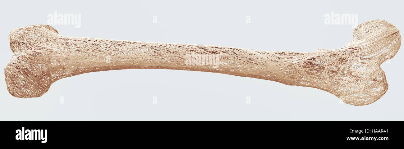 Osteoporosis - upper limb bones - 3d rendering Stock Photo - Alamy