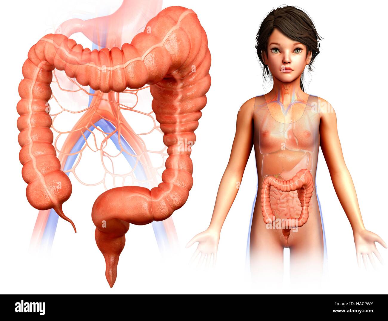 Мегаколон рентген картина. Мегаколон ирригоскопия. Токсический мегаколон гистология. Мегаколон. Идиопатический мегаколон.