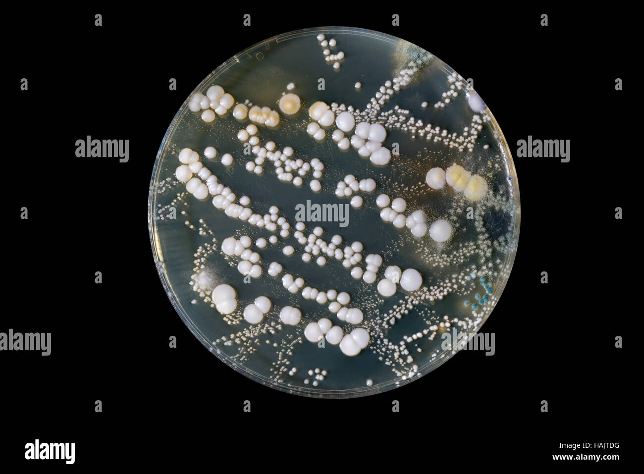 inspection of the sanitary cleanliness of the restaurant. Samples of pathogenic bacteria in petri dish Stock Photo