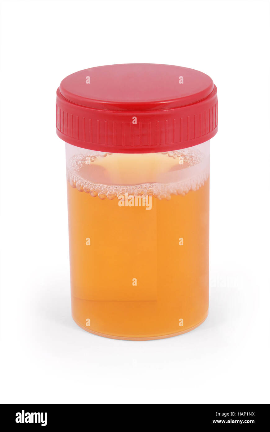 Sterile Medical container for urine with biomaterial. Clipping path