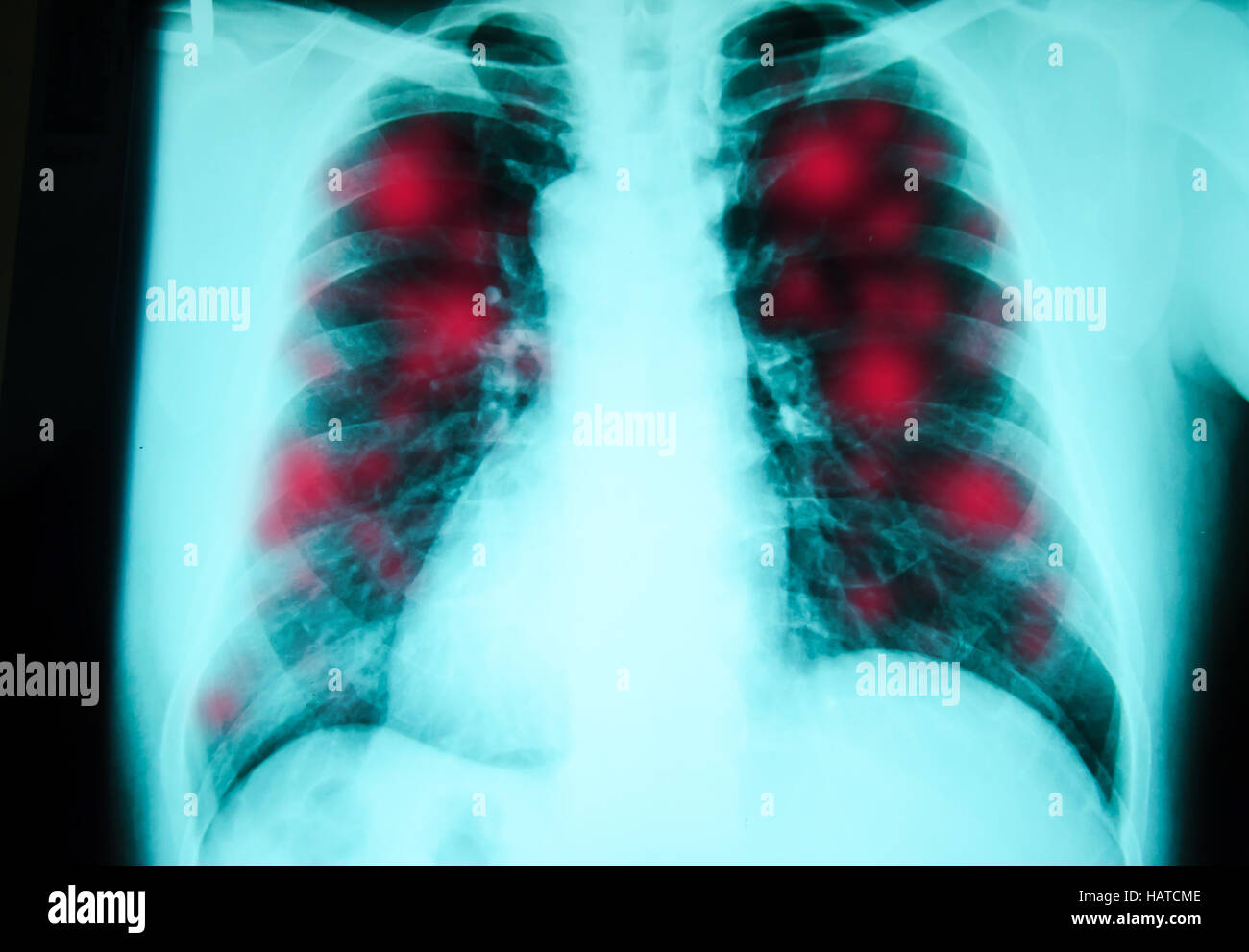 chest xray examination for diagnosis Stock Photo Alamy