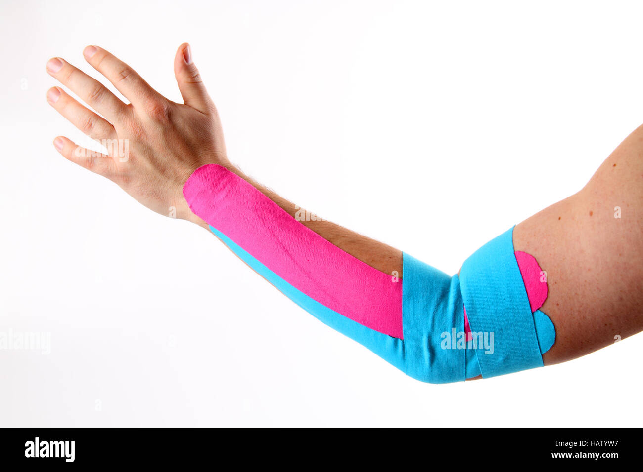 tennis elbow Stock Photo