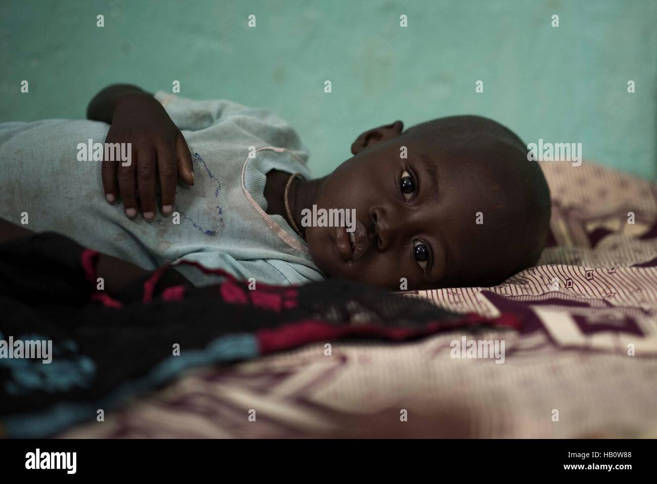 DIOILA - MALI:  A child suffering from malnutrition lays on a bed at the Intensive Nutritional Unit of the Dioila hospital on November 7 2016 in Dioil Stock Photo