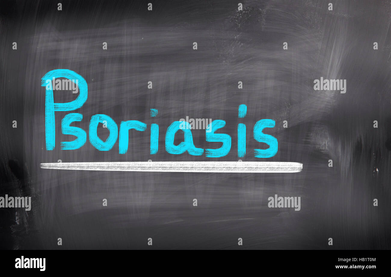 Psoriasis scratching hi-res stock photography and images - Alamy