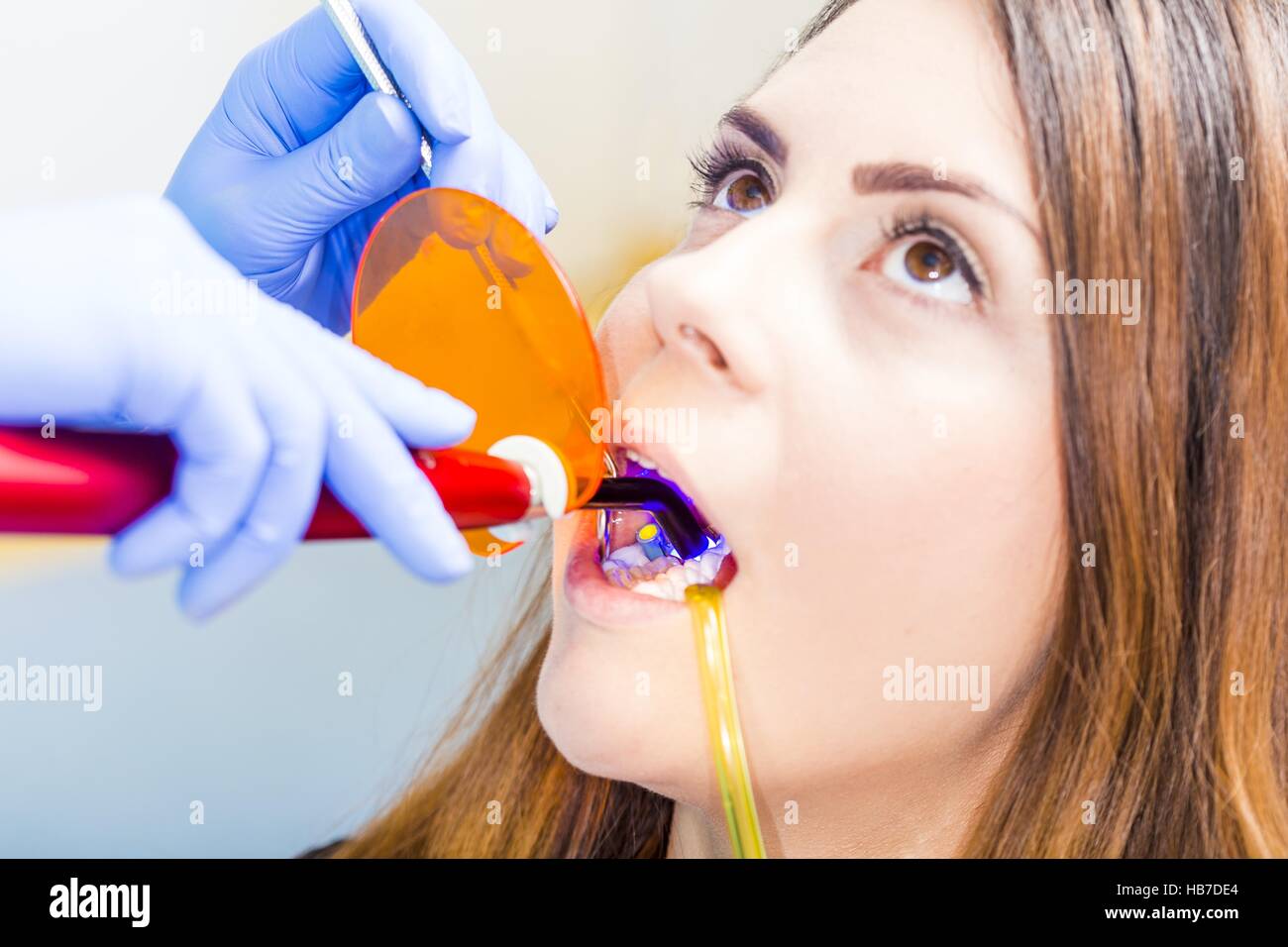 Beautiful woman patient having dental treatment at dentist's office. Stock Photo