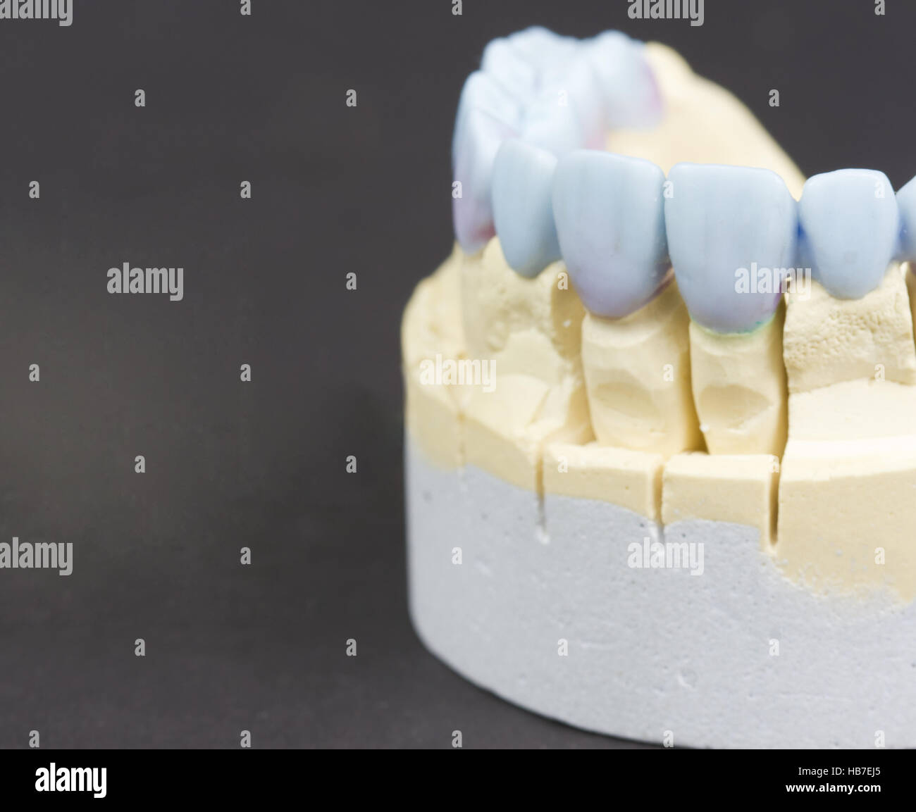 closeup for a mock up of a dental circular bridge Stock Photo