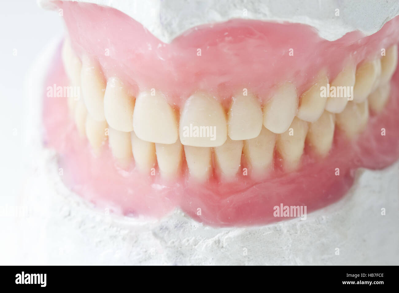Total Prothesis mock- up, for, denta,l total, prosthesis Stock Photo - Alamy